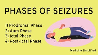 Seizure phases  Phase of seizures  Stages of Seizures  Seizure stages [upl. by Yhtomot]