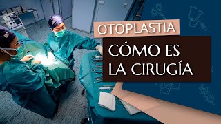 Cómo es la operación de otoplastia [upl. by Ehcnalb]