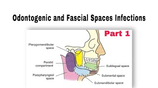 Odontogenic and Fascial Spaces Infections طب الأسنان مرحلة رابعة oralsurgery [upl. by Arotal598]