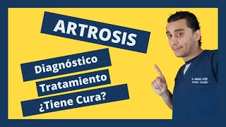 Diagnóstico y Tratamiento de la Artrosis [upl. by Eidnarb147]