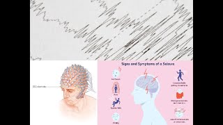 Epileptic Seizure Detection based on EEG and CNN [upl. by Nalahs]