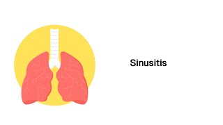 Nasennebenhöhlenentzündung Sinusitis  Erkrankungen der Atemwege [upl. by Herr]