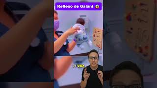 Reflexo de Galant😱👶 medicina medico pediatria enfermagem enfermeira pediatriaonline pediatra [upl. by Nole]