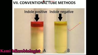 Indole test biochemical test lecture 7 [upl. by Yauq]