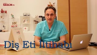 Diş Eti İltihabı  Prof Dr Bülent Kurtiş [upl. by Otreblon]