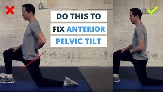 6 Minute Routine to Correct ANTERIOR Pelvic Tilt [upl. by Mable]