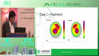 Keratoconus Management Options  Dr Shareef Hashmani  AICO 2024 [upl. by Ntsuj]