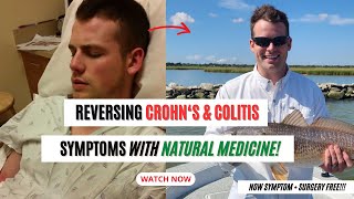 Reversing Crohns amp Colitis Symptoms with Natural Medicine [upl. by Aitam]