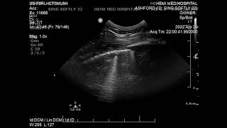 Échographie d’un poulain présentant des fractures de côtes adjacentes au cœur [upl. by Sinnylg]