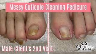 DIY Pedicure at Home for Men with Messy Cleaning  2nd Visit [upl. by Demakis201]