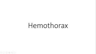 Hemothorax  General Surgery [upl. by Skolnik688]