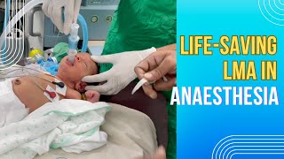 Lifesaving LMA in anaesthesia  LMA uses advantages and disadvantages are discussed [upl. by Silvestro]