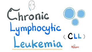 Chronic Lymphocytic Leukemia CLL  Etiology Risk Factors Symptoms Signs Diagnosis Treatment [upl. by Gilford]