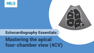 Echocardiography Essentials Mastering the apical fourchamber view 4CV [upl. by Barbarese74]