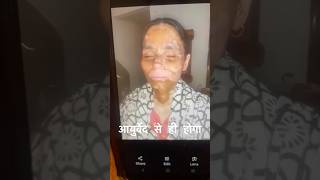 Vitiligo Recovery Incredible Transformation with Ayurveda [upl. by Yevre]