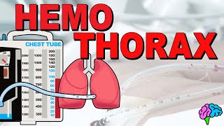 What is a Hemothorax EXPLAINED [upl. by Ebneter]