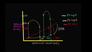 Schneid Guide to Comparison of Different PV Loops [upl. by Fernande]