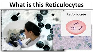 Reticulocytes [upl. by Jovita]