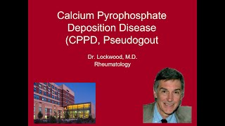 10 Calcium Pyrophosphate Deposition Disease Pseudogout [upl. by Patricia692]