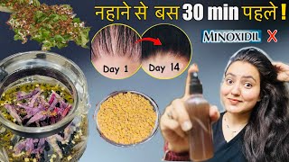 14 Days Challenge  Hair Wash से 30 मिनट पहले USE करें100 Hair Fall बंद DENSITY amp VOLUME दो गुना💕 [upl. by Nosrettap855]