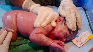 New born baby passed meconium during birth meconium mixed with vernix clean it with baby oil🥰🥰 [upl. by Costanzia604]