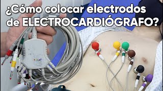 ¿Cómo colocar los electrodos de un electrocardiógrafo [upl. by Annis]