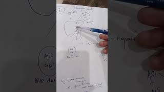 Different types of Jaundice Basic concept for First year MBBS [upl. by Ellevehc]