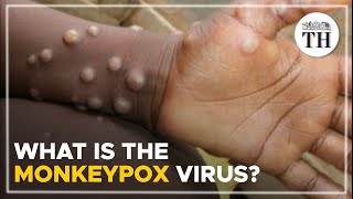 What is the monkeypox virus  The Hindu [upl. by Domenech]