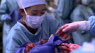 Greys Anatomy  2x10 Fin FR [upl. by Sammer630]