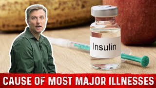 Insulin is the Cause of Most Major Illnesses – Dr Berg on High Insulin Levels [upl. by Pearce]