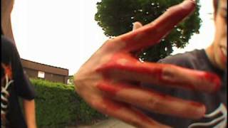 Skateboarding accidents falls crashes bails and pain Compilation [upl. by Samoht869]