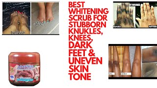 Best Whitening Scrub For Stubborn KnucklesDark Feet amp Uneven Skin ToneHow To Lighten Dark Hands [upl. by Mervin]