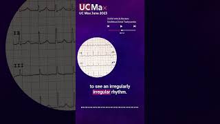 ECG Multifocal Atrial Tachycardia [upl. by Hilarius284]