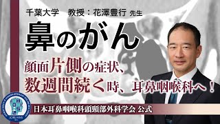 鼻副鼻腔がんについて詳しく解説 −頭頸部外科月間2022 [upl. by Ttezil]