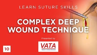 Complex Deep Wound Technique  Learn Suture Skills  VATA [upl. by Rod]