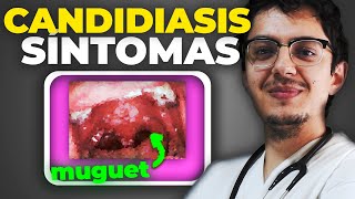 CANDIDIASIS VAGINAL y ORAL  Síntomas y TRATAMIENTO contra Candida Albicans de piel y mucosas [upl. by Eiderf]