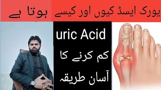 Uric Acid Ka Elaj  Uric Acid treatment in homeopathic and allopathic medicine [upl. by Naniac]