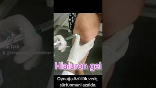 hyaluronicacid arthrosis dizağrısı [upl. by Ott]