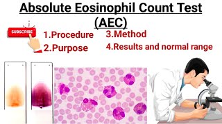 Absolute Eosinophils count ll AEC count Eosinophilia  Eosinopenia [upl. by Naomi]