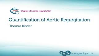 Echocardiography Quantification Of Aortic Regurgitation [upl. by Ednutey]