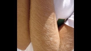 Girls arm hair [upl. by Ellerrehs571]