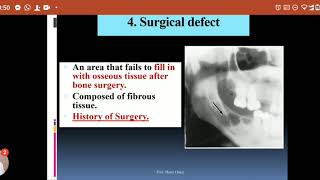 Differential Diagnosis Of Radiolucent Lesions LEC3Of Elearning [upl. by Nollek176]