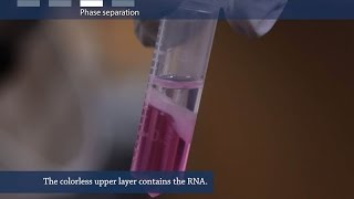 How to isolate RNA from tissue or cells [upl. by Adaynek]