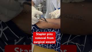 Multiple ways to close a surgical wound 1 nylon sutures 2 skin staplers 3 dermabond woundcare [upl. by Nohs]