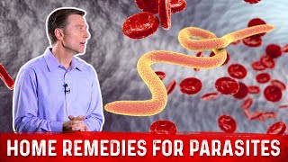 Best Home Remedies for Parasites – Dr Berg [upl. by Dimah]