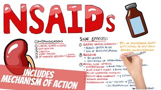 Non Steroidal AntiInflammatory Drugs NSAIDs Pharmacology  What do NSAIDs do How do NSAIDs work [upl. by Roon896]