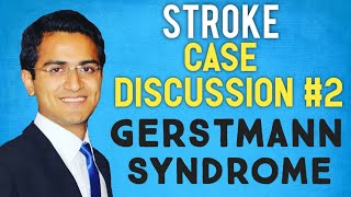 GERSTMANN SYNDROME STROKE CASE PRESENTATION STROKE CASE SCENARIO DISCUSSIONUSMLE [upl. by Joappa488]