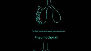 Tactile Fremitus Explained [upl. by Noiwtna70]