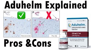 Alzheimers drug Aduhelm explained  Aducanumab and Alzheimers disease Aduhelm [upl. by Nonnel99]