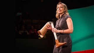 Krista Donaldson The 80 prosthetic knee thats changing lives [upl. by Newnorb]